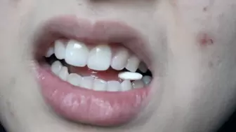 Aurora Teeth With A Mint