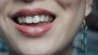 Aurora's Teeth Shine Bright Like A Diamond