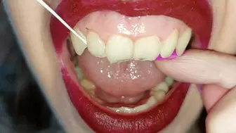 dental floss - part 5