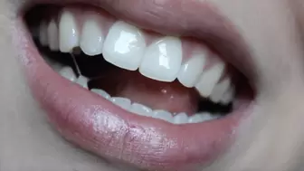 Aurora Flashes Her Teeth