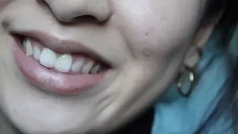 Aurora Flashes Her Teeth Again