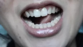 Aurora's Teeth Temptation 2