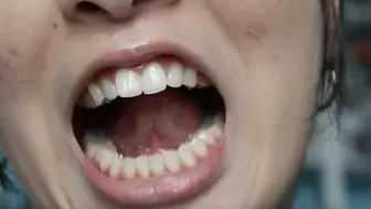 Aurora Teeth Please You