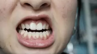 Aurora Teeth Please You 2