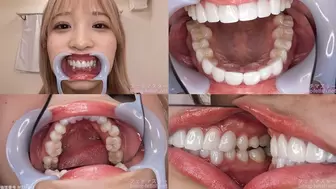 Noa - Watching Inside mouth of Japanese cute girl bite-190-1