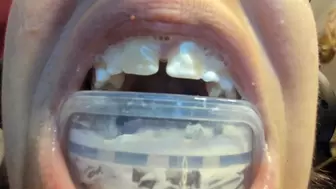 Big mouth and bite for dental treatment avi