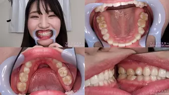 Mako - Watching Inside mouth of Japanese cute girl bite-191-1