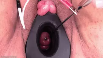 cervix e-stim treble sound fucking