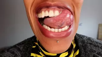 A tour of my colossal mouth