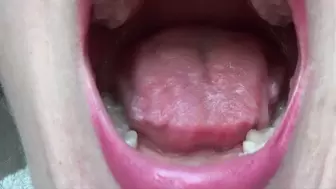 Mouth, tongue and teeth inspection 2