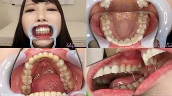 Kurumi - Watching Inside mouth of Japanese cute girl bite-193-1