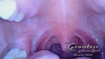 Endoscopic mouth tour