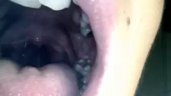 Snake gummy in my throat