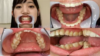 Sara - Watching Inside mouth of Japanese cute girl bite-195