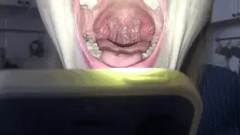 To touch the tonsils and uvula HD