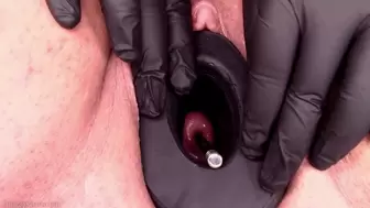 cervix masturbation