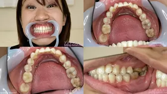 Momo - Watching Inside mouth of Japanese cute girl bite-196-1 - wmv