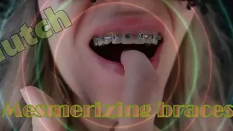 Mesmerizing braces dutch