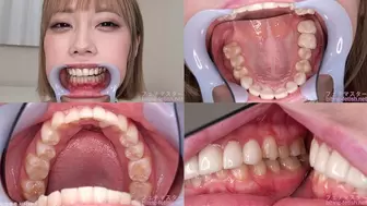 Misuzu - Watching Inside mouth of Japanese cute girl bite-198-1