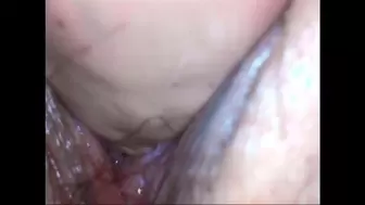 Wonderful endoscope for sperm inside the vagina avi