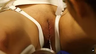 Mila's Medical Stapling and Orgasm Treatment by Nurse Roxy WMV