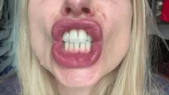 Square lips