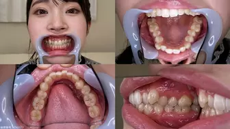 Hikaru - Watching Inside mouth of Japanese cute girl bite-200-1 - wmv