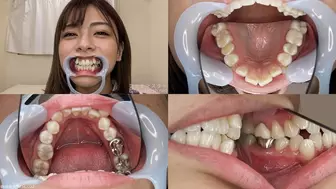 Azusa - Watching Inside mouth of Japanese cute girl bite-201-1
