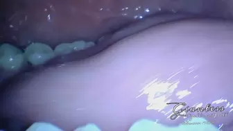 Endoscoipic side view of a blowjob