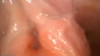 look inside my bladder
