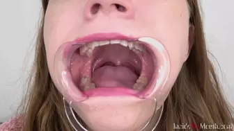 Inside My Mouth - Lola (HD)
