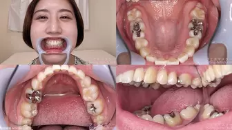 Sawa - Watching Inside mouth of Japanese cute girl bite-203-1