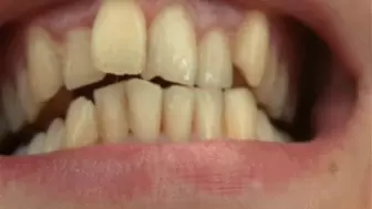 Strong, sharp teeth b