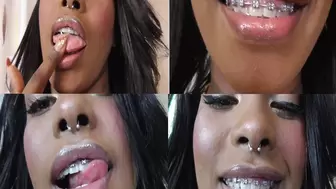 Black Girl Teeth Brace Fetish! wmv
