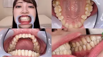 Sara - Watching Inside mouth of Japanese cute girl bite-204-1