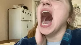 yawning breaks my mouth