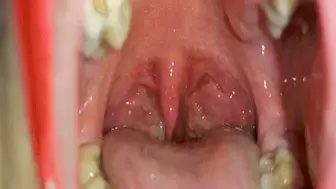My throat after ice cream WMV(1280*720)HD