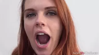 Inside My Mouth - Julie got mouth exam (HD)