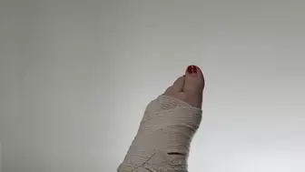 Harlow's bandaged up foot