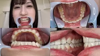 Reira - Watching Inside mouth of Japanese cute girl bite-210-1