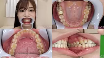 Rino - Watching Inside mouth of Japanese cute girl bite-208-1