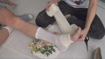My broken leg and masturbation with bandaging