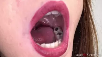 Inside My Mouth - Karolina got mouth exam (HD)