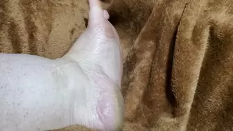 swollen dirty crusty soles