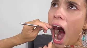 Inside My Mouth - Barbara got mouth exam (HD)