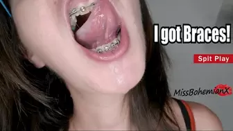 I got Braces! Spit Play and Kisses - First Mouth Tour with Brackets - MissBohemianX - HD MP4