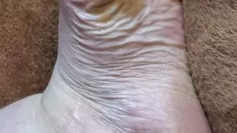 Wiggling toes and showing off calloused and wrinkled sole