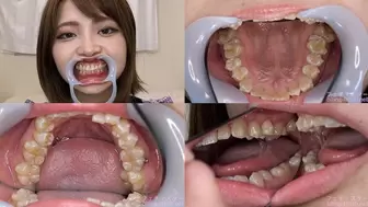 Rui - Watching Inside mouth of Japanese cute girl bite-213-1