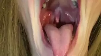 TONGUE, TONSILS AND UVULA PUT ON A SHOW