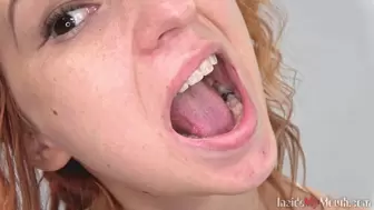 Inside My Mouth - Alex got a mouth exam (HD)
